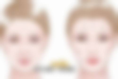 割了双眼皮肿的厉害怎么办？冰敷消肿+饮食调理3天见效