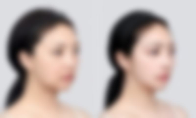 佳木斯熙氰医疗美容诊所价格表