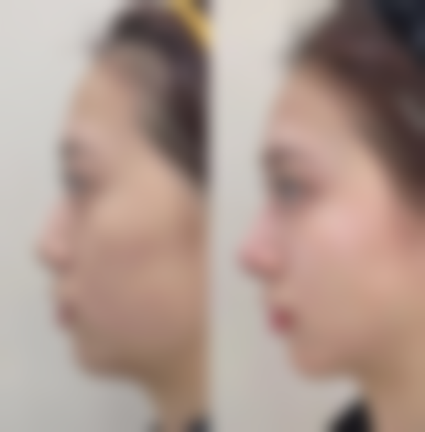 李星星医生顾客实例图片