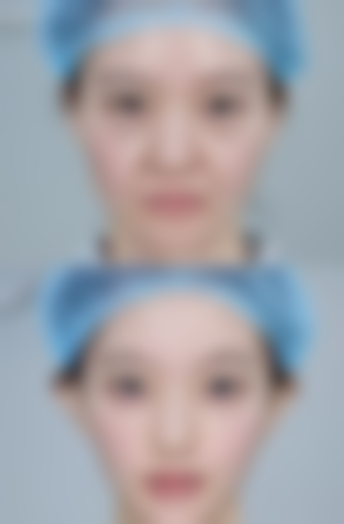 淄博张店丽美医疗美容门诊部顾客实例