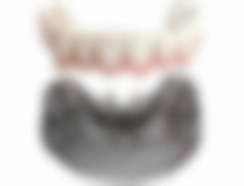 割双眼皮要肿多久？三甲医院VS私立医院消肿时间大揭秘，专业医生教你快速恢复！