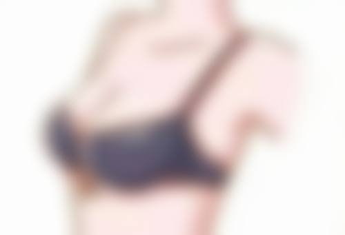 大型综合医院割双眼皮的消肿保护