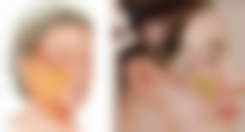 指甲抠的疤痕修复常见误区