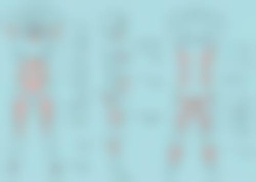 红色凹陷疤痕怎么消除：激光消除之点阵激光的神奇魔法