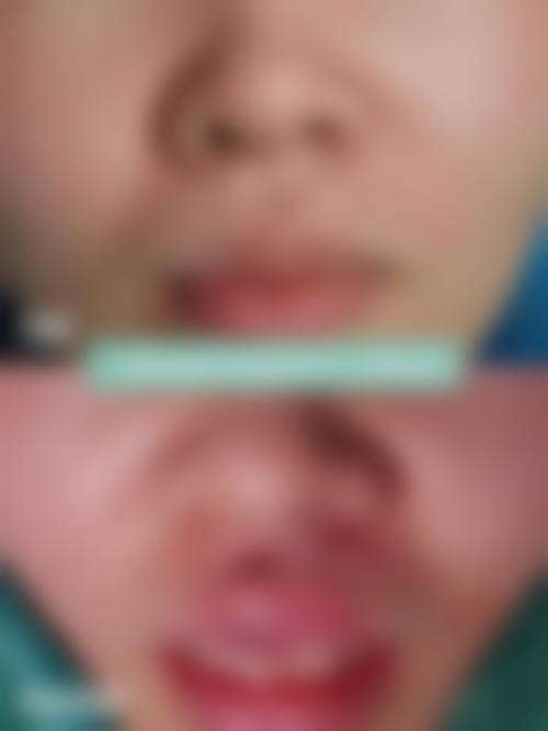 东莞东华医院眼科价格表