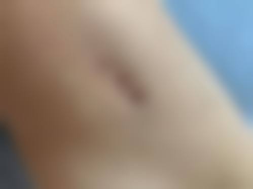 焦作蒙娜丽沙整形医院口碑好不好