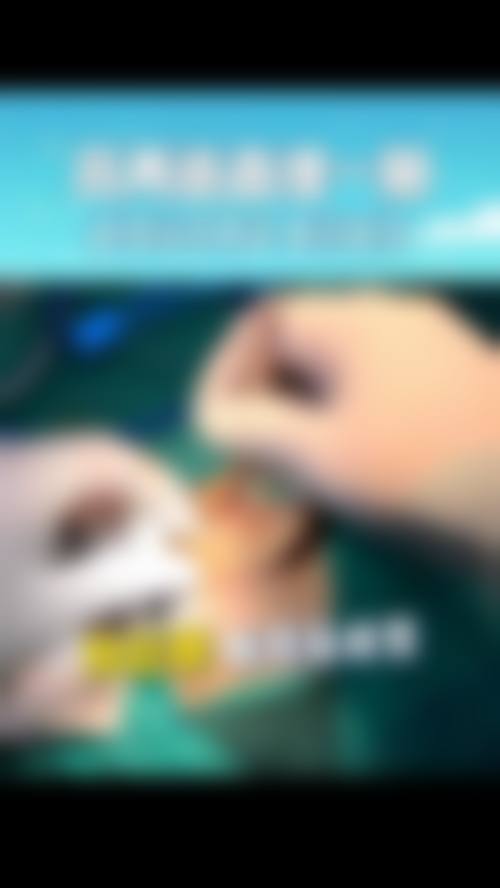 范锴医生口碑如何