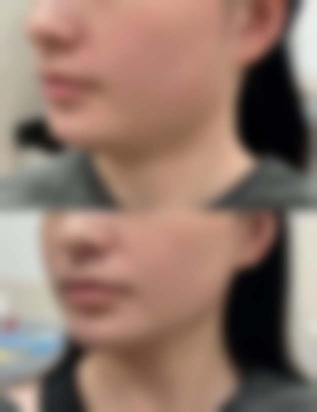 四、西安晗美印象整形美容医院怎么样项目特色