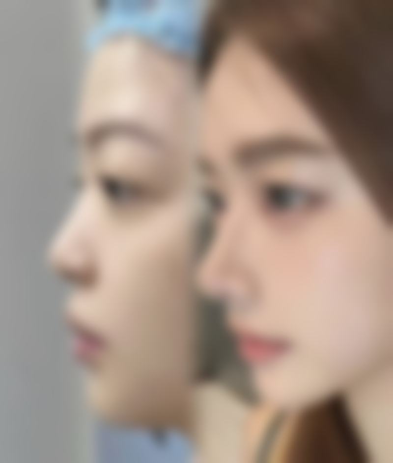 焦作蒙娜丽沙整形医院项目特色