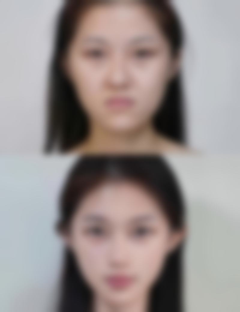 不同类型指甲抠的疤痕专精处理建议