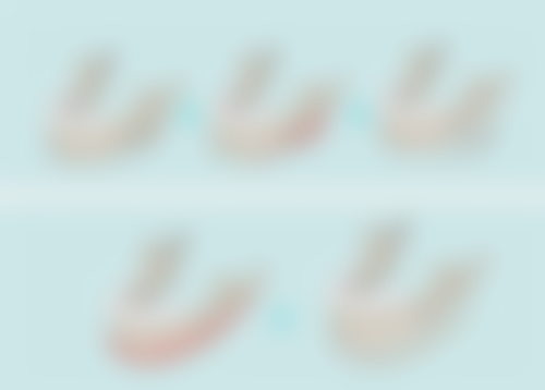 做假体隆胸:真实实例中的风险教训