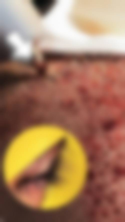 深圳雍禾美度整形门诊部价格表