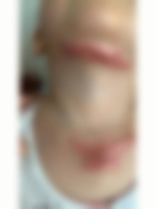 乐清晏美上奥拉克医疗美容诊所可靠吗