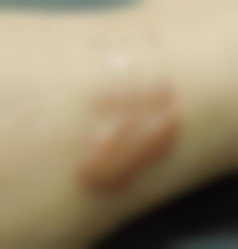 临清市铭昊医院医疗美容科怎么样——项目特色