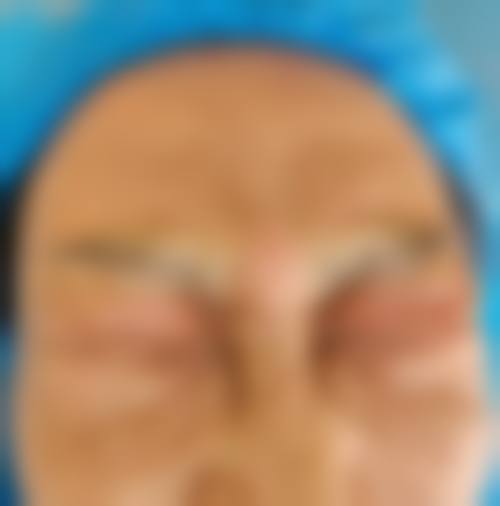 杜恺医生简介做手术价格