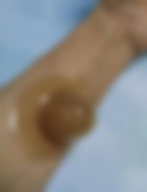 杜恺医生简介口碑如何