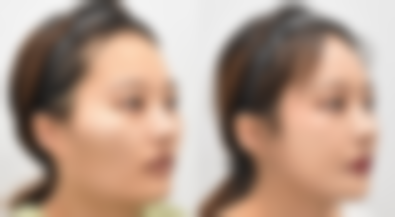 尾段：美丽是场马拉松，不是百米冲刺