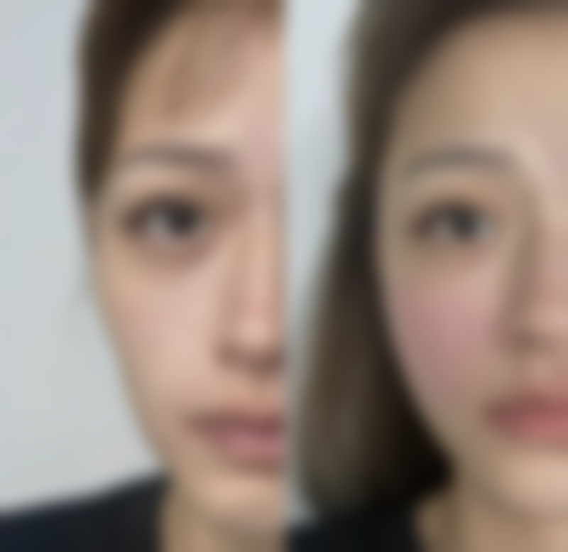 临清市铭昊医院医疗美容科怎么样——口碑好不好？附真实患者口碑评价