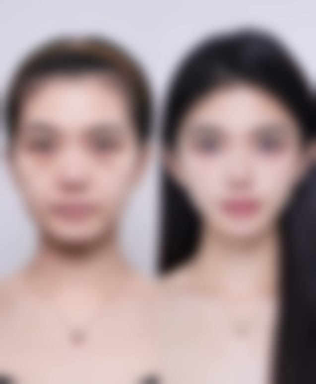 郑州香格丽雅整形医院价格表