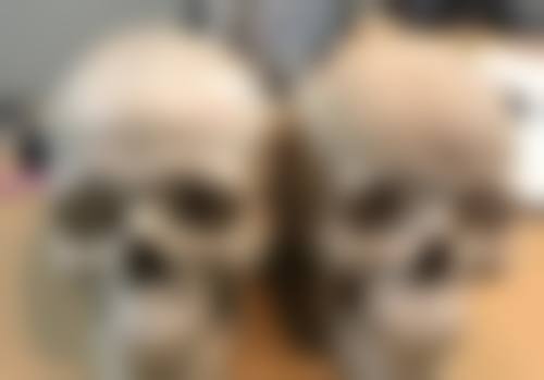 如何使手术疤痕修复：优雅处理术后“纪念品”