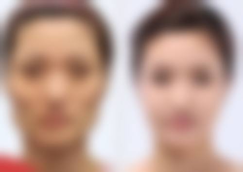 姚文华医生简介之项目优势