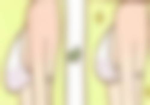 割双眼皮后眼睛闭不上怎么办？3大原因解析+5步修复指南，恢复期护理必看