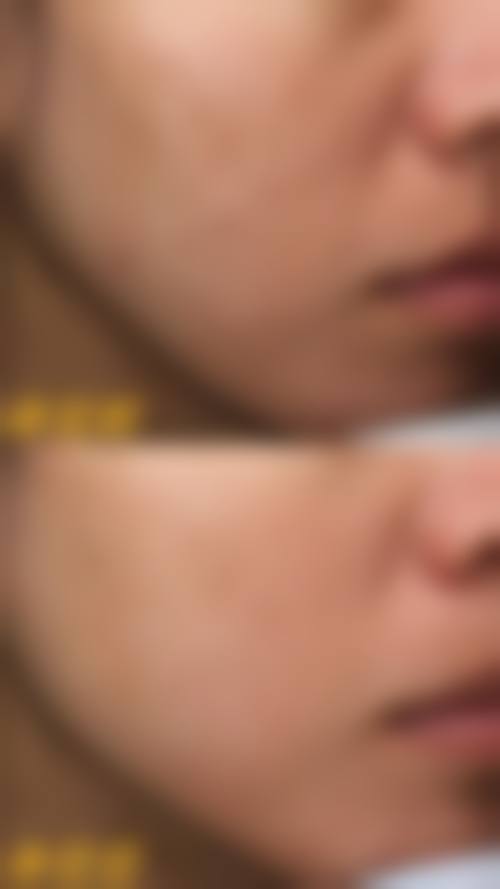 宁波象山华美美容整形医院口碑好不好