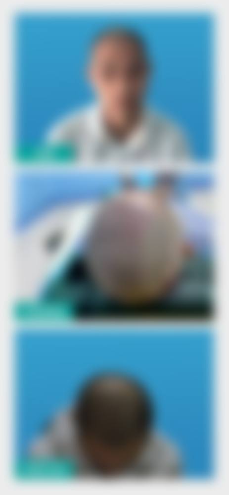 西安碑林科 大医院整形科口碑好不好