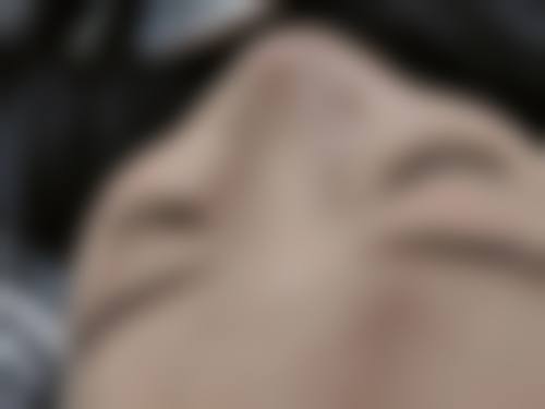 长沙新生毛发种植研究院怎么样之抖音团购与价格表