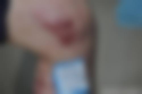 南通英莎医疗美容门诊部李辉手术成功几率——崇川科禾医疗美容诊所