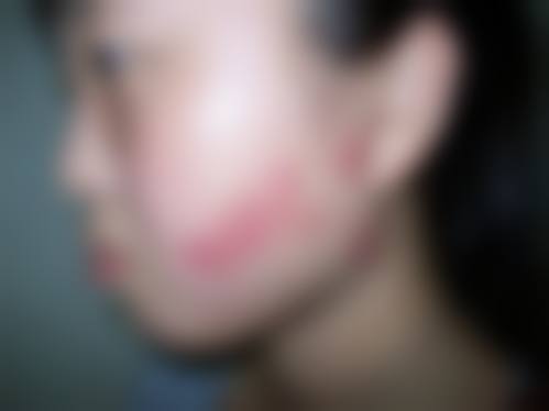 南通英莎医疗美容门诊部李辉手术成功几率——汇美医学美容诊所