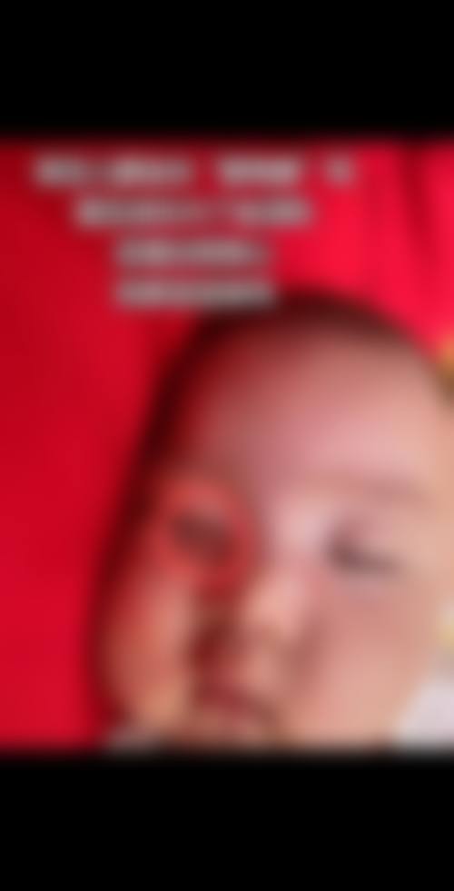 南通英莎医疗美容门诊部李辉手术成功几率——如皋星秘医疗美容门诊部