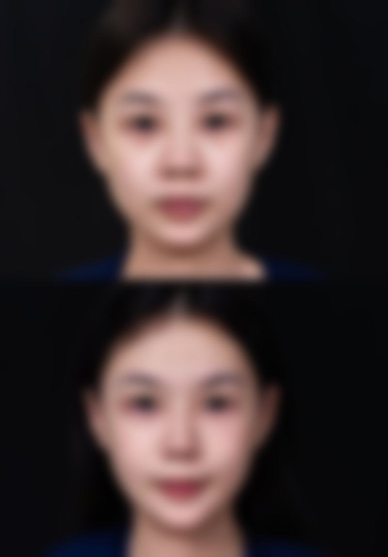 郑州大桥医院医疗美容科地址及乘车路线