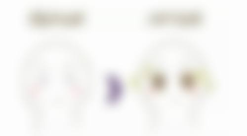 消除眼袋的10种方法有哪些，按摩+食疗+手术+冰敷全攻略速看