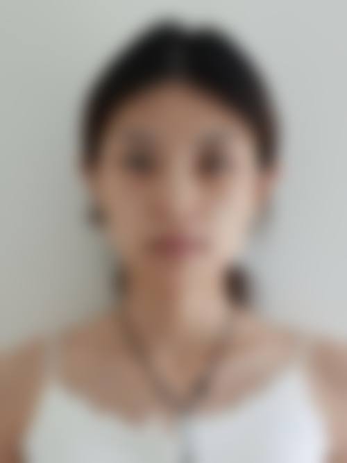 北京中月宏整形美容门诊部怎么样，顾客实例