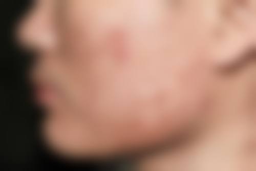 青岛瑧妍美医疗美容医院资质团队与宋秀娥技术的可靠支撑