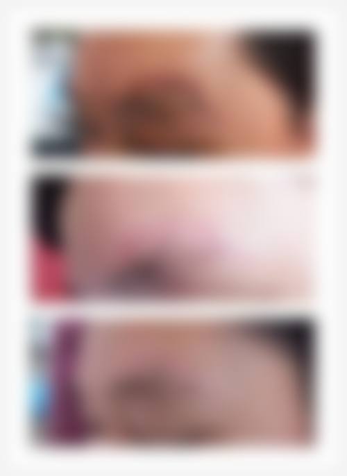 北京中月宏整形美容门诊部怎么样，更擅长什么