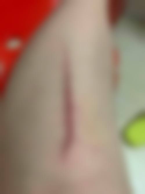 北京中月宏整形美容门诊部怎么样，价格表