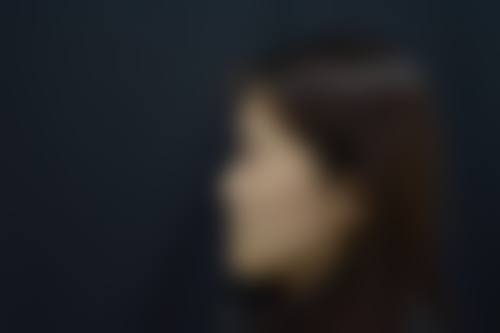 石家庄诚楠痤疮医疗美容诊所更擅长什么手术