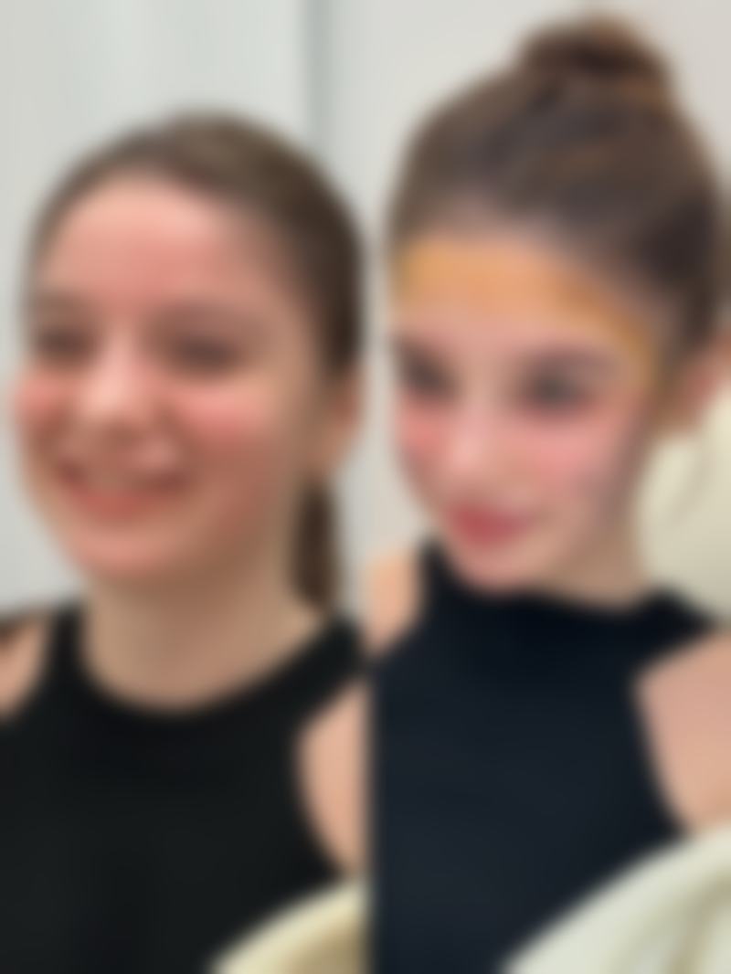 脸上凹陷疤痕涂抹祛疤膏之olioli祛疤膏——高能冠军的实力展现