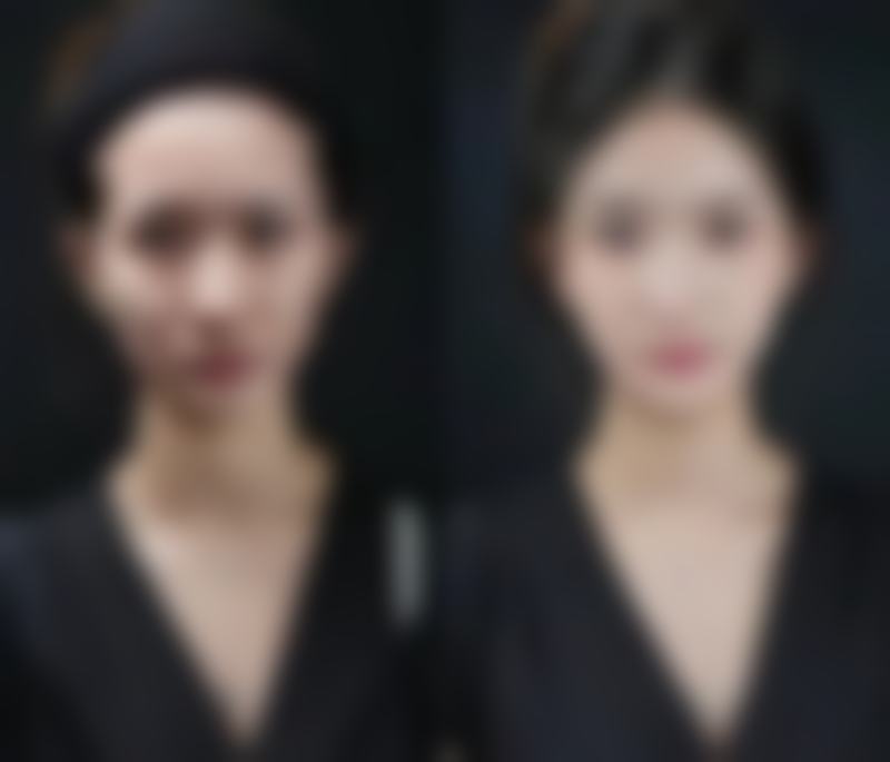 昆明拾光童话整形医院口碑评价如何