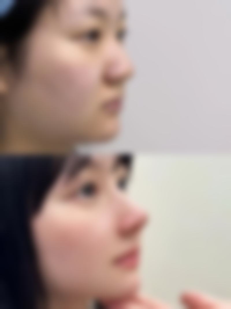 消除眼袋的10种方法有哪些——急救型去眼袋妙招