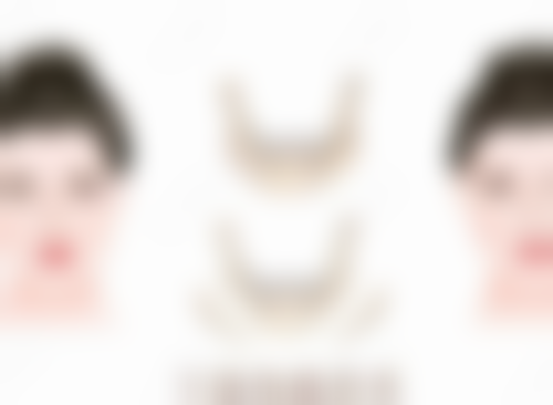 开水烫伤疤痕如何消除之治疗时间与成效预期