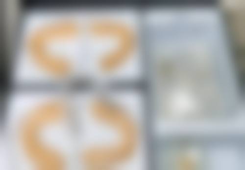 头发种植究竟好不好——持久性篇