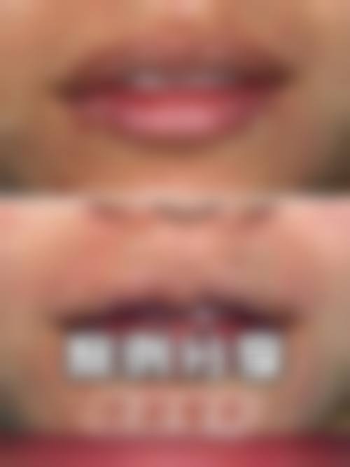 株洲嘉美医疗美容口碑好不好