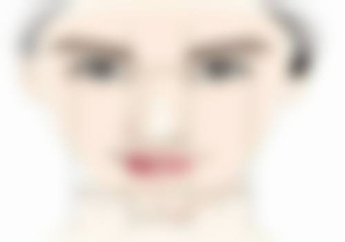 眼袋手术两侧不对称能修复吗:能完全修复吗?修复后成效如何?