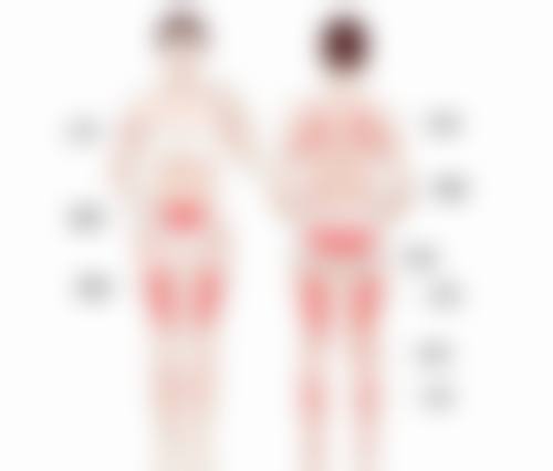 假体隆胸水滴和圆形稳定性区别：安分守己 VS 活泼好动