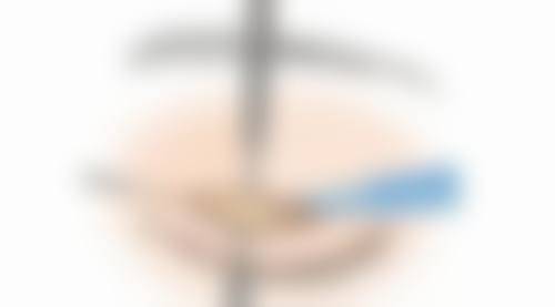 张家界市永定区肖兴平诊所(瑞美整形)价格表