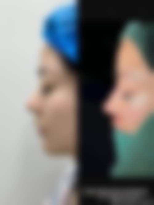 佛山仙迪汇整形医院怎么样:口碑评价