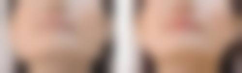 北京紫美韵整形医疗美容诊所评价